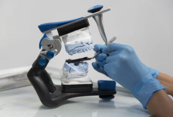 robotic implant placement