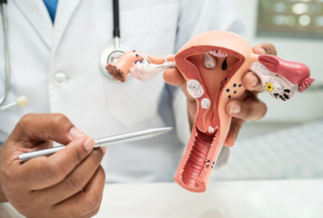 Uterine Cancer Explained