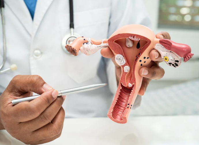 Uterine Cancer Explained
